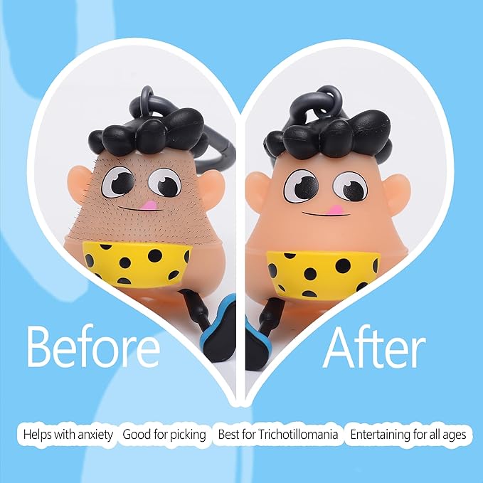 Polka Trichotillomania Fidget Toys,Pimple Popping Toy Picking Hair Pulling Fidget Toys,Skin Picking Toy Birthday Halloween Christmas Gag Gifts for Anxiety Relief&ADHD in 14+ Ages and Adults
