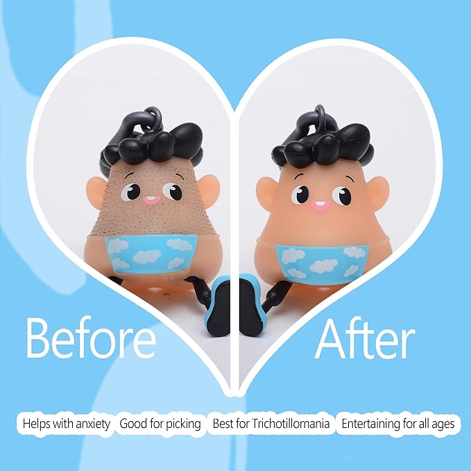 Sky for 14+ Ages Hair Pulling Fidget,Trichotillomania Pop Fidget Toys,Gag Novelty,Asmr Picking Stress Relief Toy,Anti Anxiety Venting Novelty Toys Birthday Party Favors