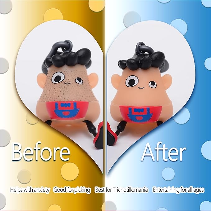 HanHan Skin Picking Fidget Toys Picking for Trichotillomania Fidget Toys to Stop Hair Pulling Picking Anxiety ,ADHD Autism,Cute Stress Relief Perfect 14+ and Adult Christmas Birthday Gag Gifts